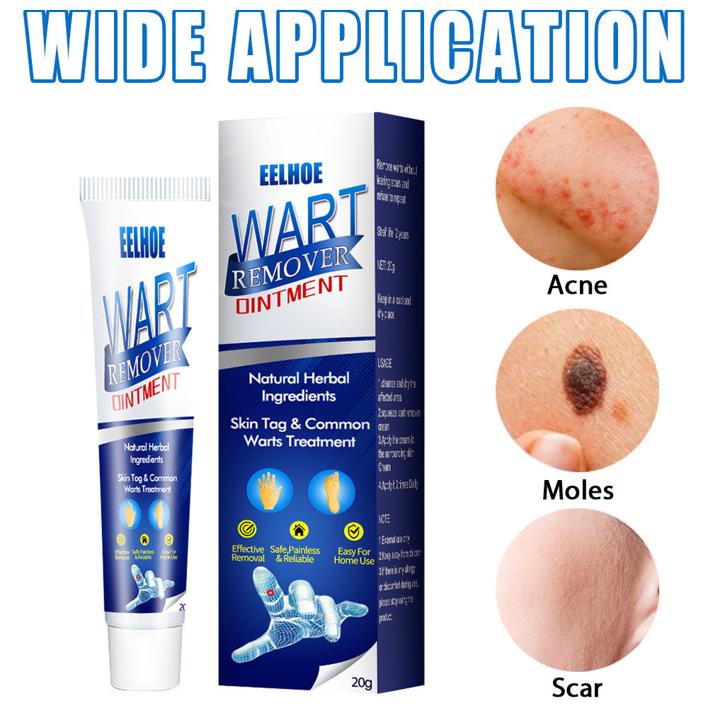 Wart Remover Cream – Fast & Effective