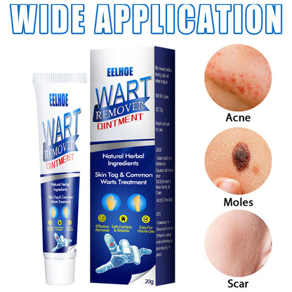 Wart Remover Cream – Fast & Effective