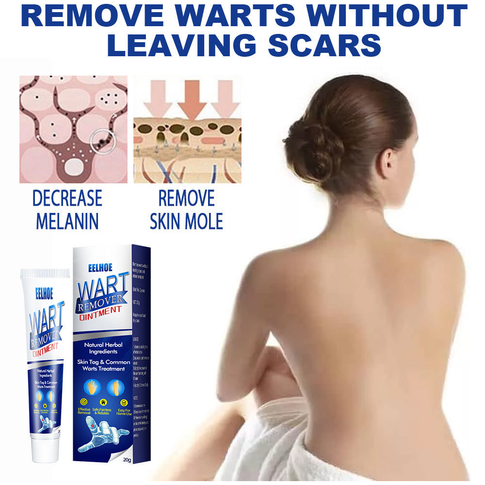 Wart Remover Cream – Fast & Effective