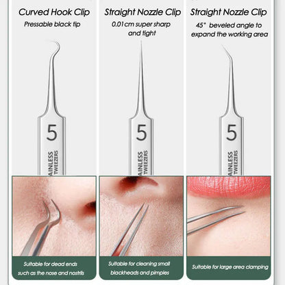 Acne Blackhead Removal Tool