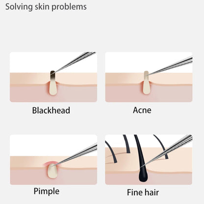 Acne Blackhead Removal Tool